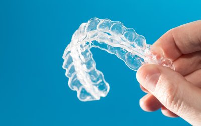 La parodontite : une maladie silencieuse qui impacte bien plus que vos dents